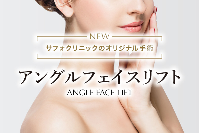 アングルフェイスリフト