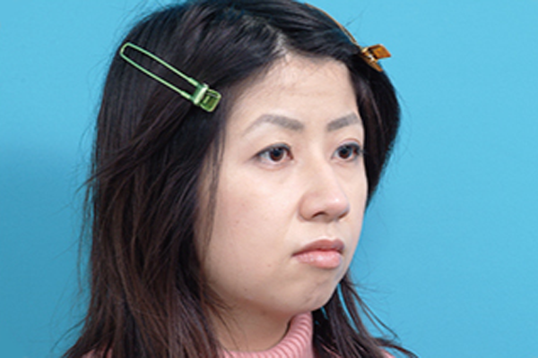 フェイスリフトのモニター写真