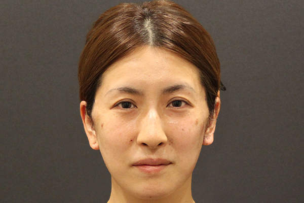 ミニリフトモニター写真