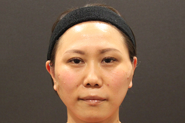 ミニリフトモニター写真
