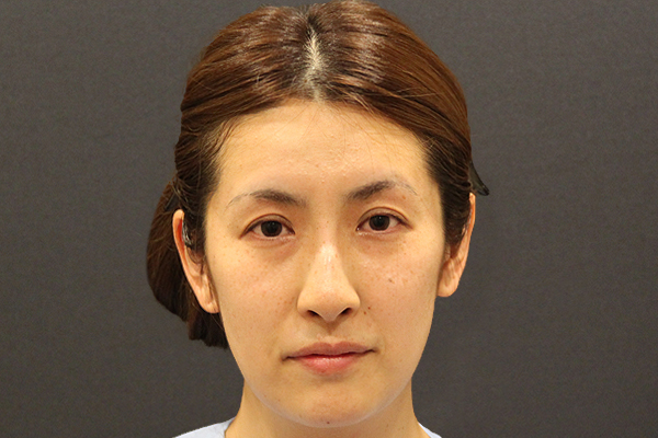 ミニリフトモニター写真